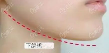 下頜線位置圖片參考