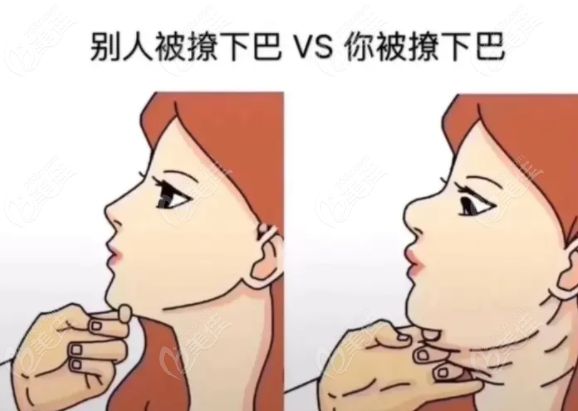 快速消除肥胖型双下巴哪种方法比较好