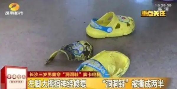 這種鞋不少人都愛穿！穿著舒服，但正在毀掉你的腳！趕緊自查