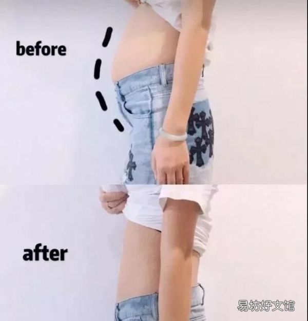 吸脂術(shù)后怎么選擇塑身衣