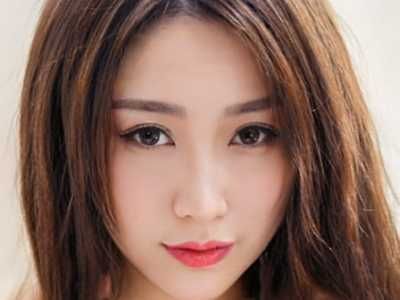 icl近視矯正的特點(diǎn)及效果「icl近視矯正真實(shí)效果對(duì)比圖」