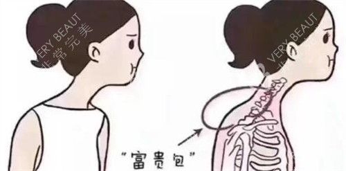 脖子富贵包卡通图展示照片