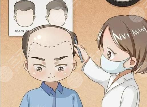 植發(fā)