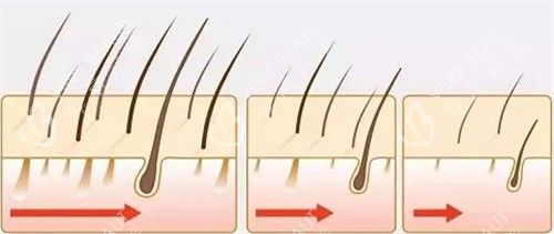 毛发生长方向细节动画图