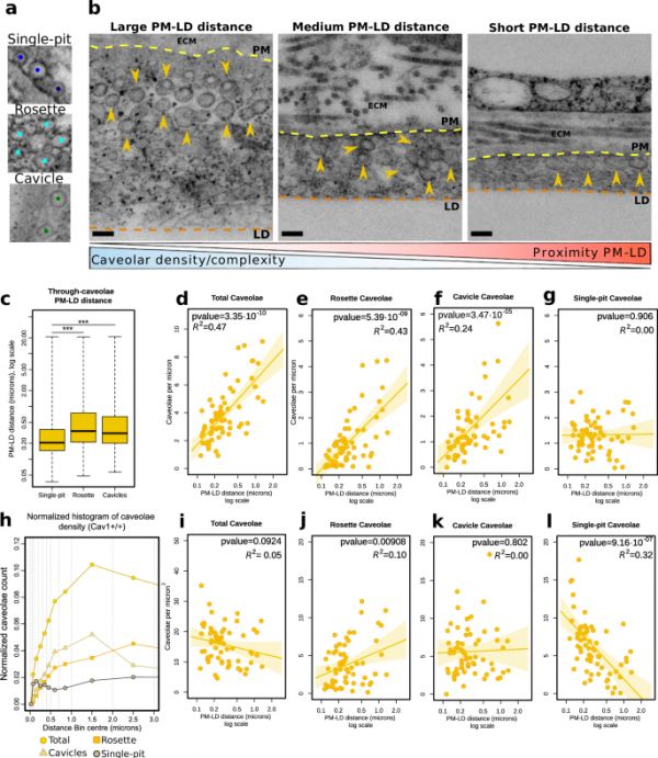 Plasma membrane remodeling determines adipocyte expansion and mechanical adaptability