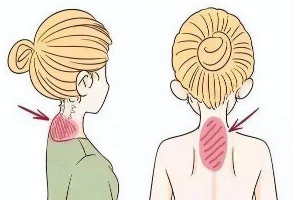 长沙哪里治富贵包好www.okostu.com