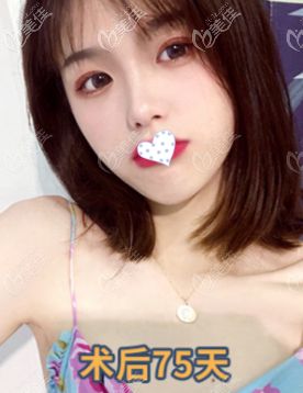 臉型好看了很多
