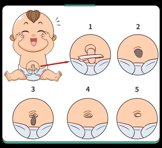 貼減肥肚臍貼有什么副作用？剖析減肥貼的真相(1)