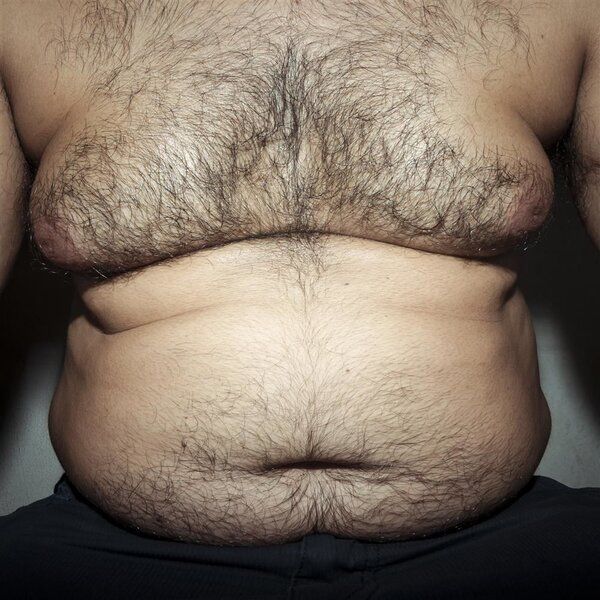 李氏拔罐針灸減肥的食譜