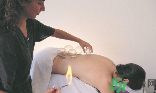 在家拔罐需要注意什么？在家拔罐幾天拔一次？