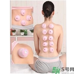 在家拔罐需要注意什么？在家拔罐幾天拔一次？