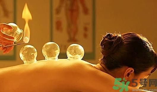 在家拔罐需要注意什么？在家拔罐幾天拔一次？
