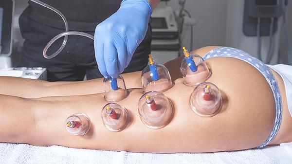 拔罐后不能吃什么东西