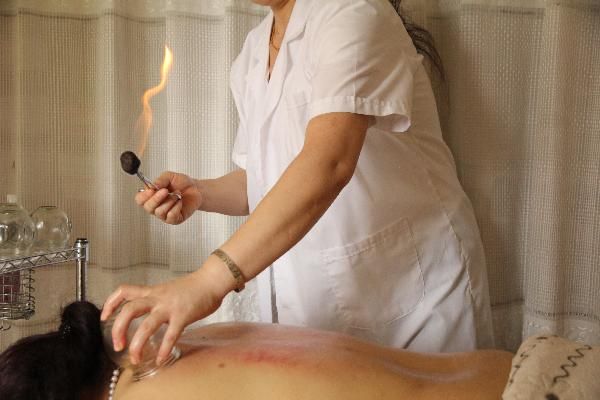 肚子上怎樣拔罐減肥