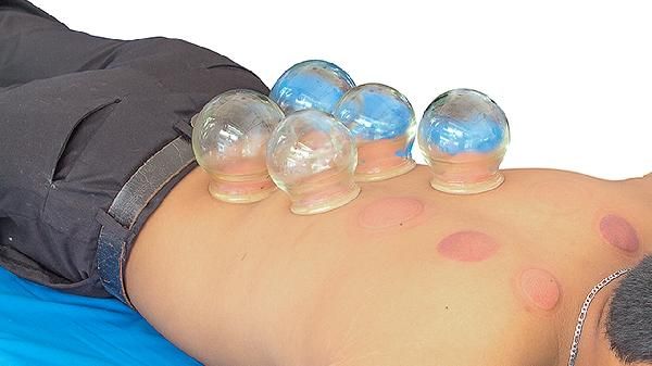 什么情況下不能拔罐