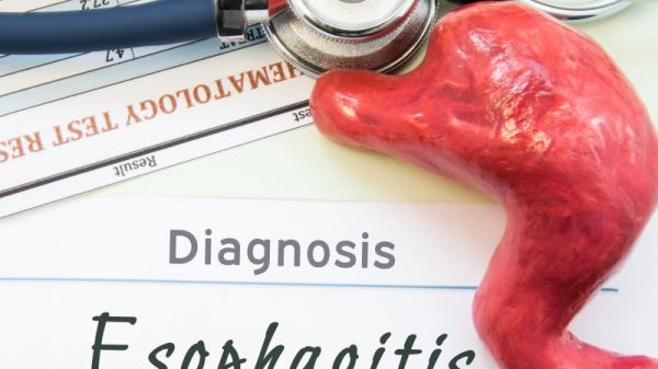 胃痛拉肚子怎么治療