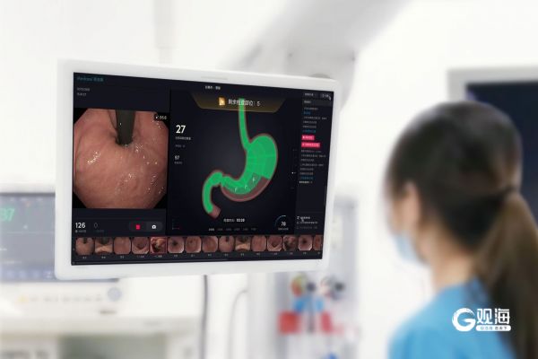 醫(yī)生在內鏡檢查時應用AI輔助診療系統。黃飛 攝