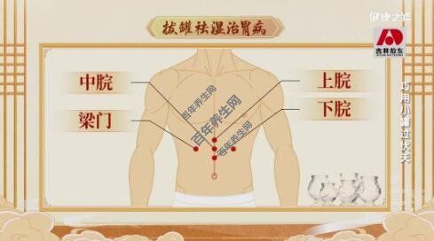 拔罐祛濕治胃病