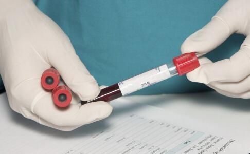 女性體檢做哪些檢查 女性的健康體檢有哪些 保護(hù)女性健康要做哪些體檢