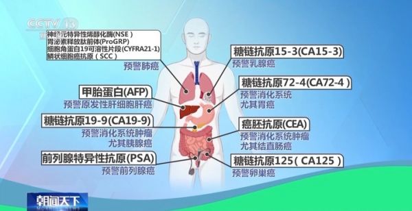 常見指標(biāo)如何解讀？一文看懂體檢報(bào)告