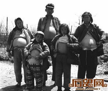 中國(guó)百年疾病變遷：從營(yíng)養(yǎng)不良到“富貴病”