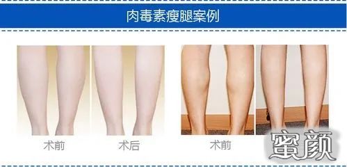 https://img.miyanlife.com/mnt/Editor/2022-03-28/62418b862bacc.jpg