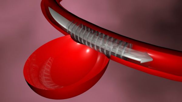 预防动脉硬化的食物