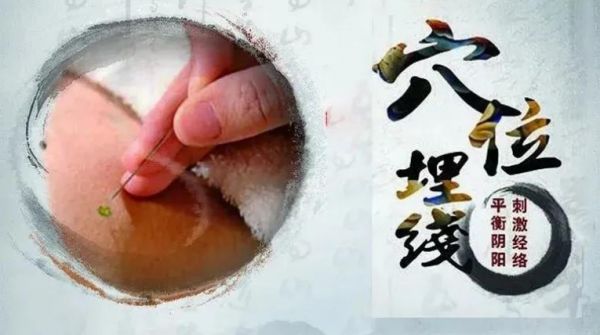 穴位埋線減重——助您輕松享“瘦”