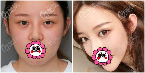 5G天使光雕對比效果圖