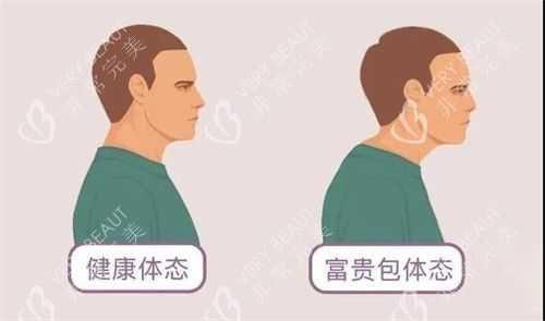 曹孟君富貴包治療動畫圖