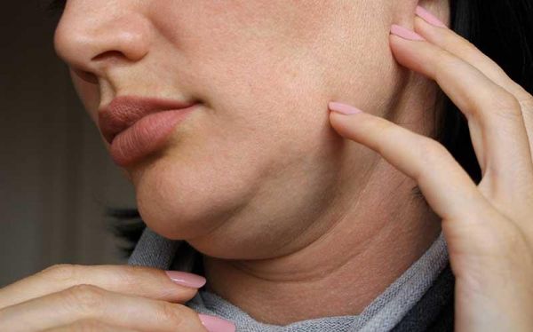 Lose Double Chin - Causes and Treatments | Amaris B. Clinic, Dr Ivan Puah