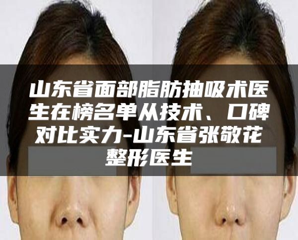 山東省面部脂肪抽吸術(shù)醫(yī)生在榜名單從技術(shù)、口碑對(duì)比實(shí)力-山東省張敬花整形醫(yī)生