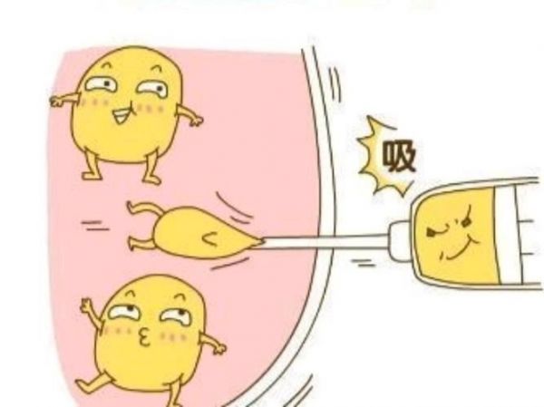 腹部吸脂減肥：科學(xué)有效的瘦身方法(2)