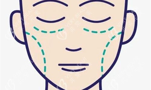 面部填充劃線圖