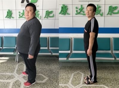 游泳圈、啤酒肚如何才能快速消掉？長春康達7.jpg