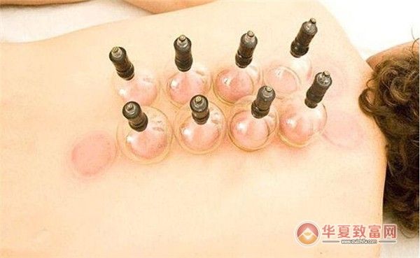 拔罐減肥儀器加盟