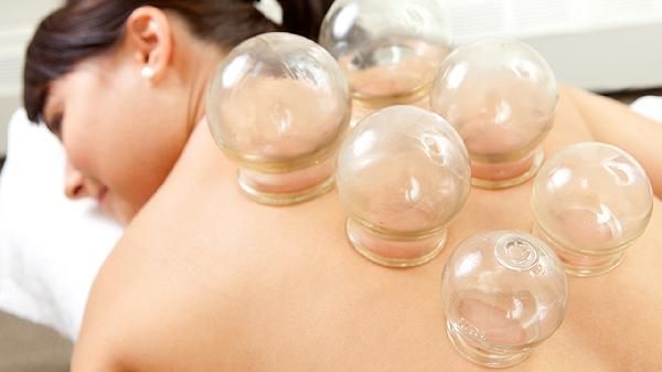 拔罐减肥需要封多少天罐