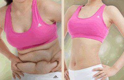 全身減肥儀器價(jià)格全身減肥儀器多少錢一臺(tái)（圖）_3