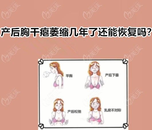 產(chǎn)后胸干癟萎縮幾年了還能嗎