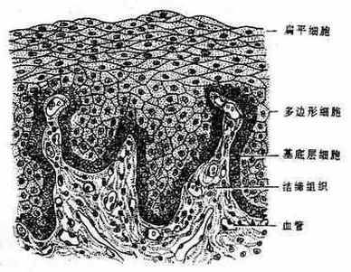 復(fù)層扁平上皮
