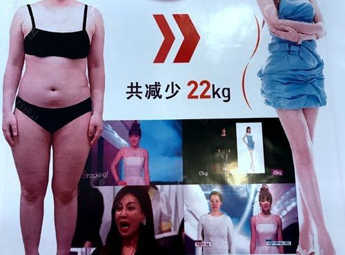 韓國(guó)吸脂減肥哪家醫(yī)院好？韓國(guó)抽脂減肥成功瘦身的例子多嗎？