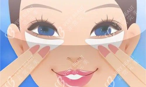 敷眼袋卡通圖