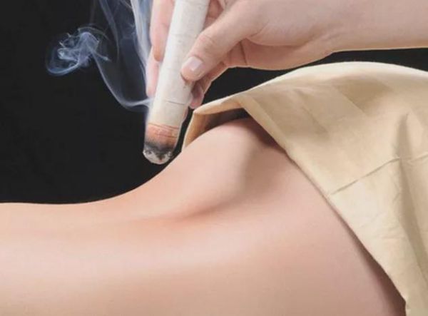 拔罐減肥 拔火罐減肥有效嗎_中藥拔罐減肥加盟店_拔罐減肥
