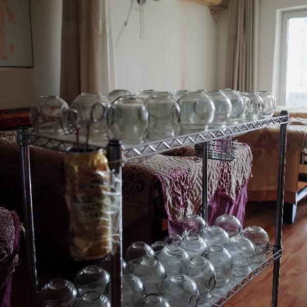 拔罐减肥一般需要多久后不反弹