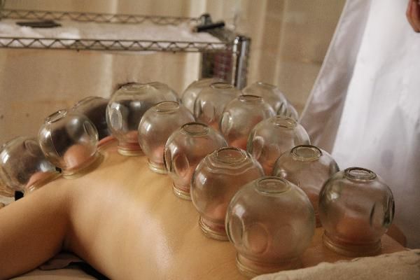 拔罐减肥最后要封罐和巩固吗