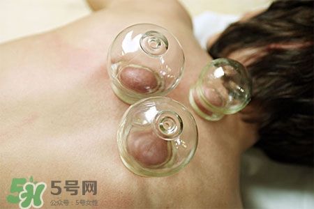 拔火罐自己在家能不能拔？在家拔罐的三大注意事項(xiàng)