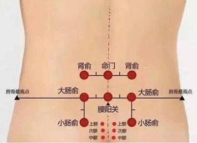 确保拔罐安全的四大步骤，建议收藏！