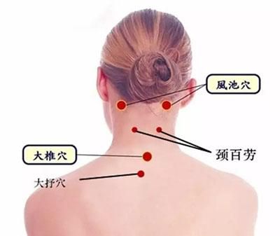 确保拔罐安全的四大步骤，建议收藏！