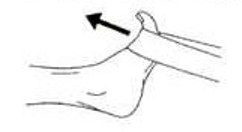 resisted dorsiflexion