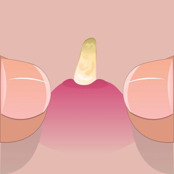太原治療性功能異常伴發(fā)的精神障礙醫(yī)院口碑推薦